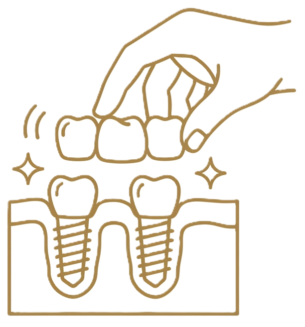 odbudowa-protetyczna-i-most-ostateczny-new-3