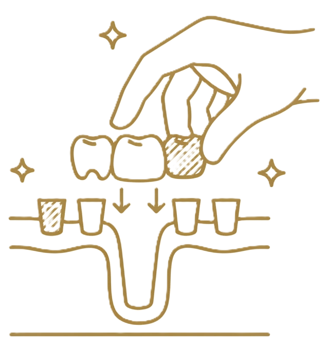 tymczasowy-most-protetyczny-new-3