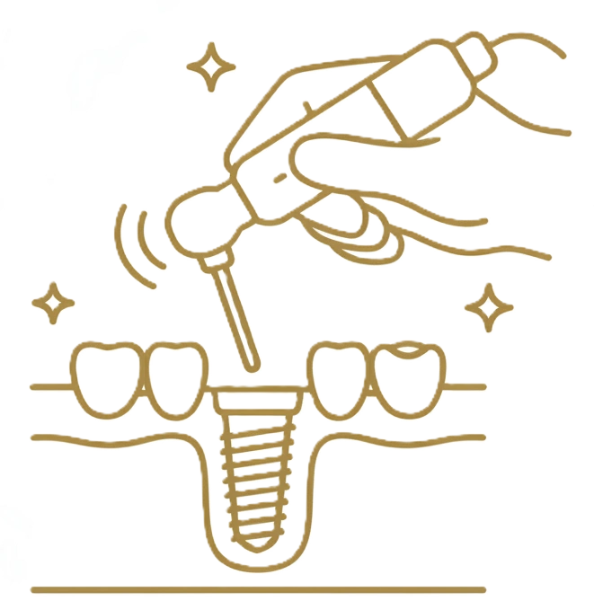 wszczepienie-implantow-new-3